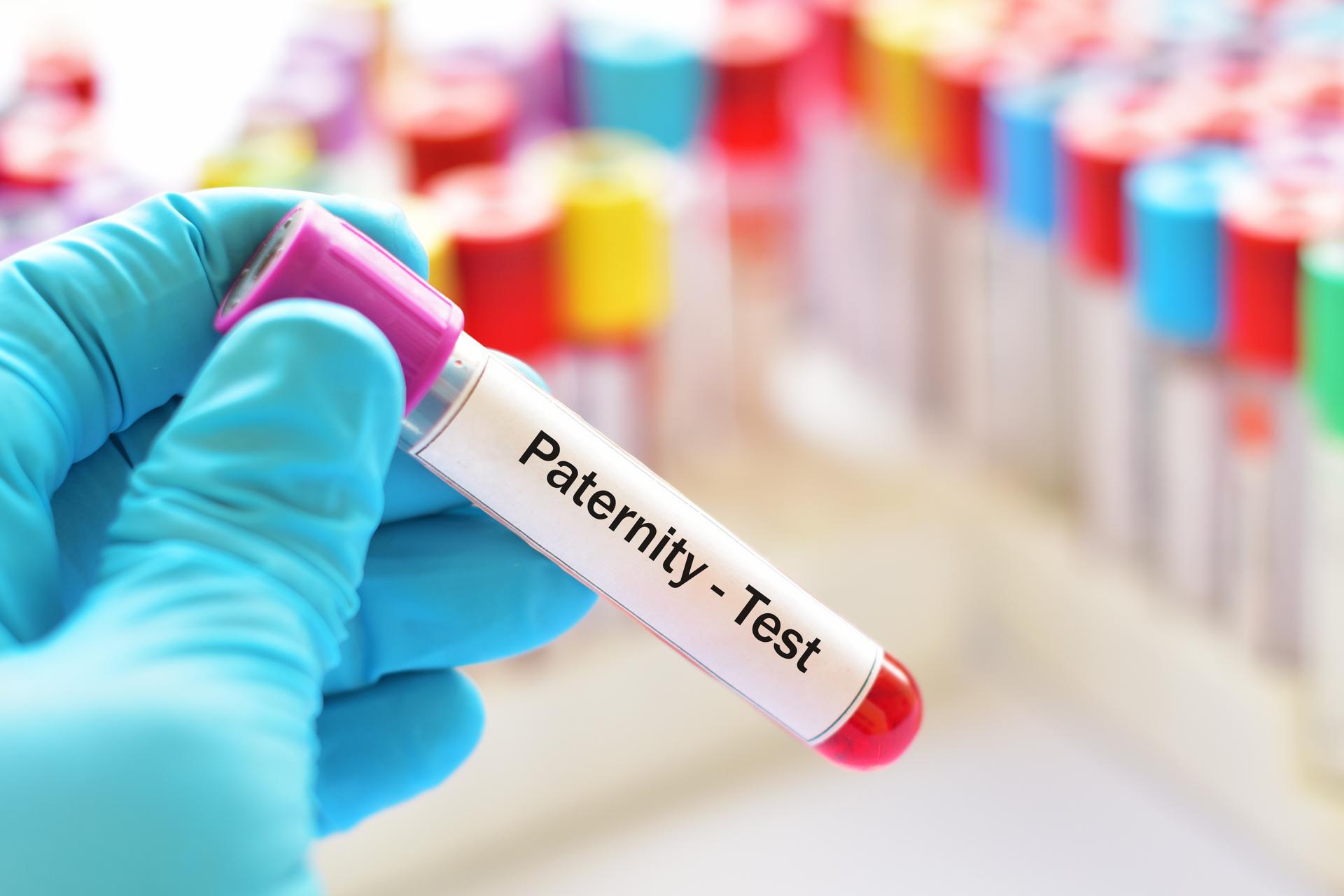Laboratory DNA Analysis